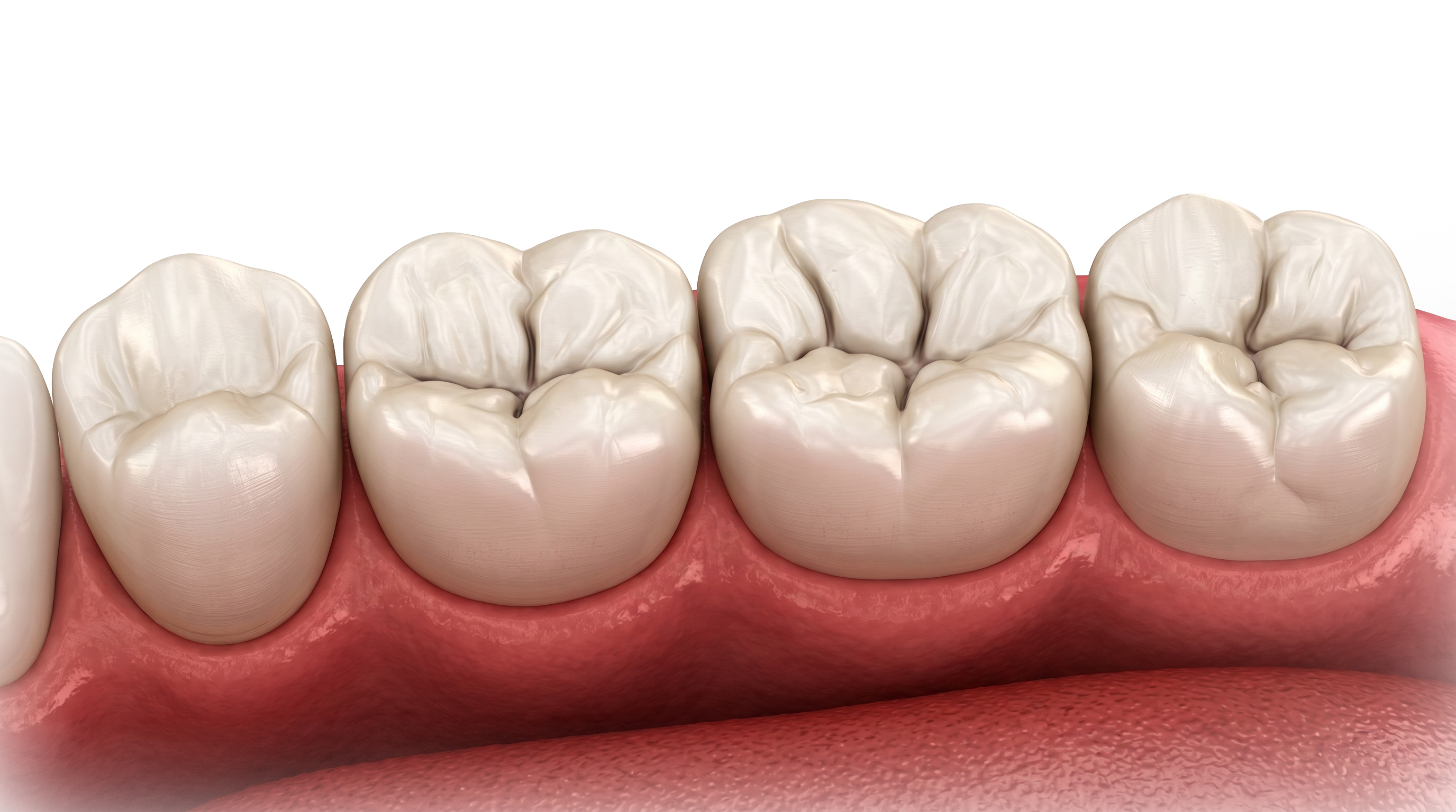White dental model